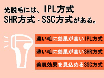 光脱毛の種類は3種