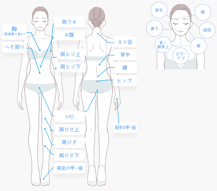アリシクリニックの全身脱毛部位