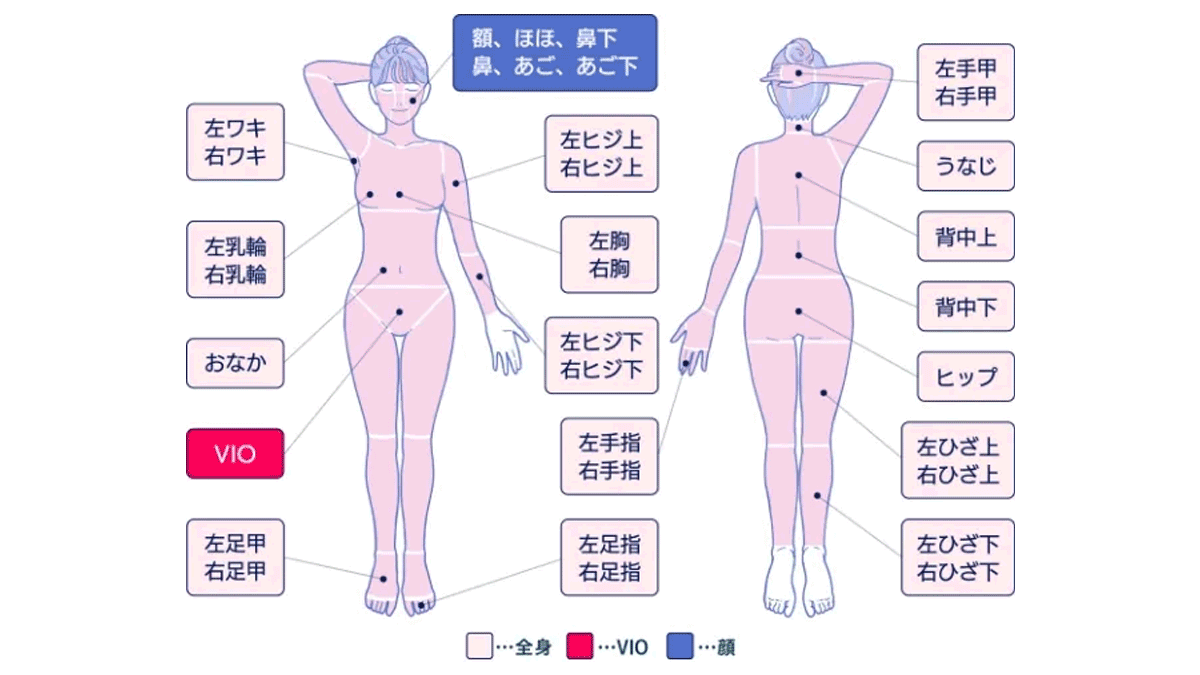 フレイアクリニックの全身脱毛料金