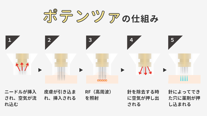 薬剤を真皮層まで届けられる